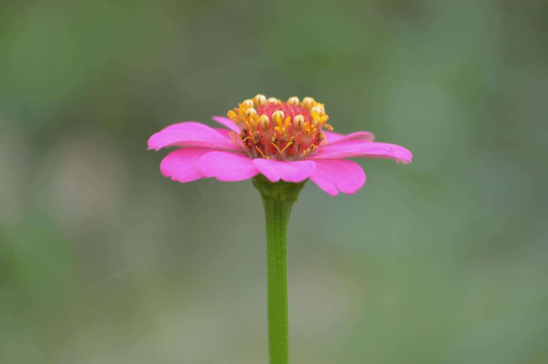 その他の膵臓疾患